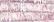 MIC0007 Pink